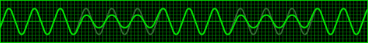 Fluctuaciones de Voltaje (Flicker)
